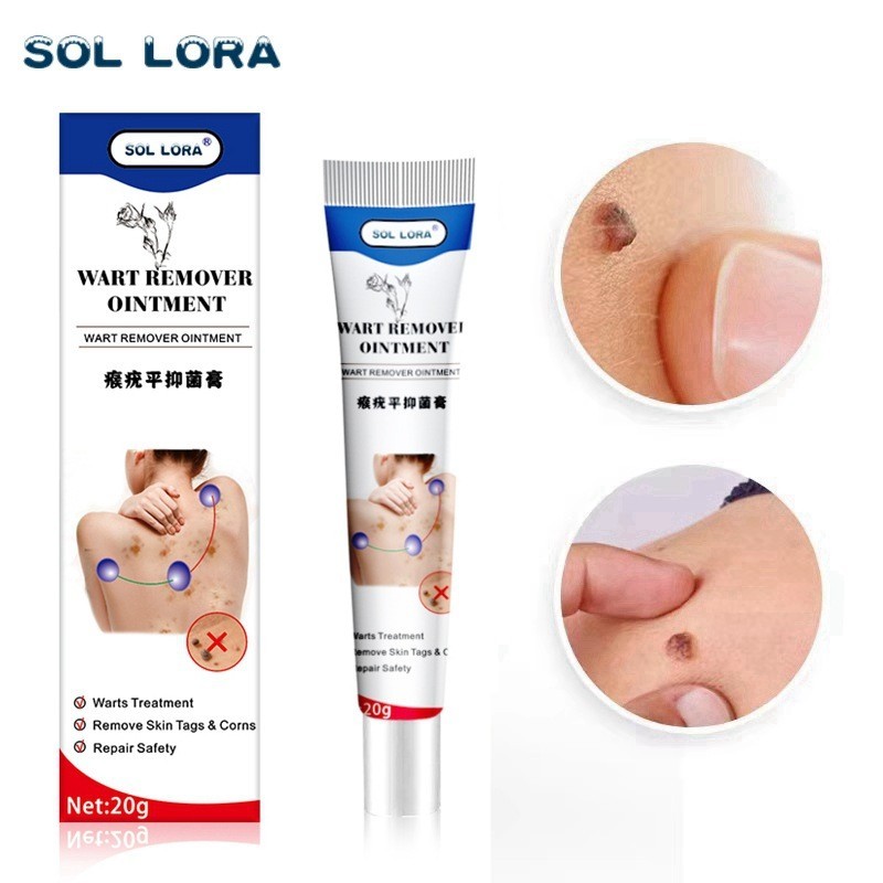 Qu Yu Gao Huang Ping Pomada Para Verrugas De Seda Manchas De Olhos De Frango Qu Yu Gao Huang Ping Pomada Para Verrugas De Seda Manchas De Olhos De Frango - Oferta na Shopee