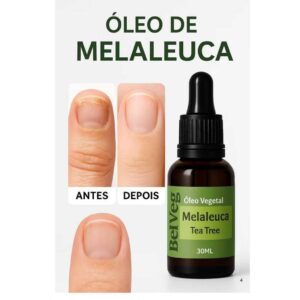 Óleo Vegetal Melaleuca Tea Tree 100% Puro 30ml Para Unha Pele Cabelo antifúngico micose - Oferta na Shopee