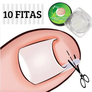 Fita Órtese Desencravar Unha Encravada Corretora 10 Peças - Oferta na Shopee